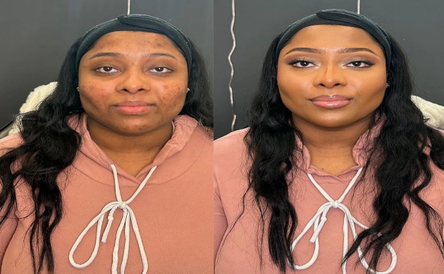 Bareface Esthetics client picture